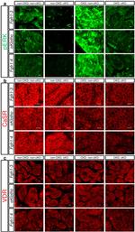 Calcium Sensing Receptor Antibody in Immunohistochemistry (IHC)