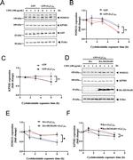 Importin beta-1 Antibody in Western Blot (WB)