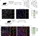 MUC1 Antibody in Immunohistochemistry (IHC)