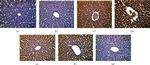 p53 Antibody in Immunohistochemistry (IHC)