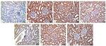 Bcl-2 Antibody in Immunohistochemistry (IHC)