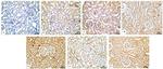 p53 Antibody in Immunohistochemistry (IHC)