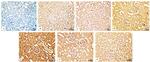 TNF alpha Antibody in Immunohistochemistry (IHC)