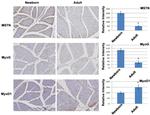 MYOD Antibody in Immunohistochemistry (IHC)