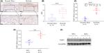 Thrombospondin 1 Antibody in Western Blot, Immunohistochemistry (WB, IHC)