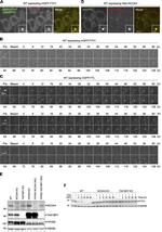 Ferritin Antibody in Immunocytochemistry (ICC/IF)