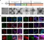 ISL1 Antibody in Immunohistochemistry (IHC)