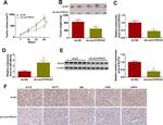 MMP9 Antibody in Immunohistochemistry (IHC)