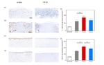 TGF beta-1 Antibody in Immunohistochemistry (IHC)