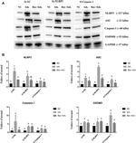 PYCARD Antibody in Western Blot (WB)