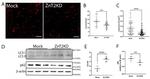 SQSTM1 Antibody in Western Blot (WB)