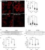 SQSTM1 Antibody in Western Blot (WB)