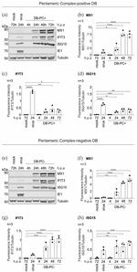 MX1 Antibody in Western Blot (WB)