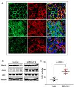 PDK1 Antibody in Immunohistochemistry (Paraffin) (IHC (P))