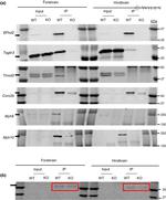 Tropomodulin 2 Antibody in Western Blot (WB)