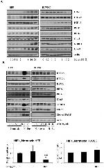 HIF-2 alpha Antibody in Western Blot (WB)