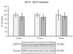 GRP78 Antibody in Western Blot (WB)