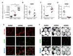 beta-1 Adrenergic Receptor Antibody in Immunohistochemistry (IHC)