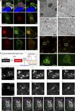 PCSK2 Antibody in Immunocytochemistry (ICC/IF)