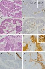 Androgen Receptor Antibody in Immunohistochemistry (IHC)