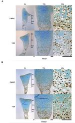 ABCA1 Antibody in Immunohistochemistry (IHC)