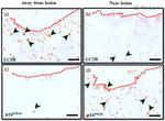 p19ARF Antibody in Immunohistochemistry (IHC)