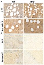 LC3A/LC3B Antibody in Immunohistochemistry (IHC)