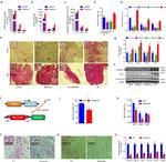 UCP1 Antibody in Immunohistochemistry (IHC)