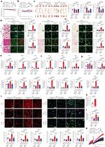 UCP1 Antibody in Immunohistochemistry (IHC)