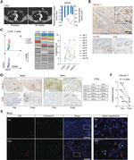 Granzyme B Antibody in Immunohistochemistry (IHC)