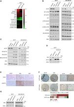 Estrogen Receptor beta Antibody in Western Blot (WB)