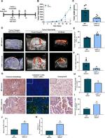 Granzyme B Antibody in Immunohistochemistry (IHC)