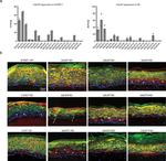 Involucrin Antibody in Immunocytochemistry (ICC/IF)