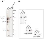 PTGDS Antibody in Western Blot (WB)