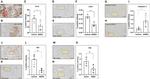 Cannabinoid Receptor 1 Antibody in Immunohistochemistry (IHC)