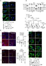 XPG Antibody in Western Blot (WB)