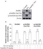 Phospho-DAPK1 (Ser734) Antibody in Western Blot (WB)