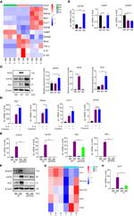 GATM Antibody in Western Blot (WB)