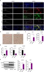 GATM Antibody in Western Blot (WB)