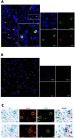 CD103 Antibody in Immunohistochemistry (IHC)