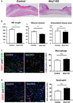 Myeloperoxidase Antibody in Immunohistochemistry (IHC)