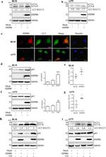 SQSTM1 Antibody in Western Blot (WB)