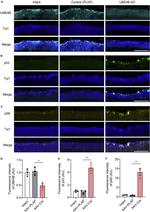 UBE4B Antibody in Immunohistochemistry (IHC)