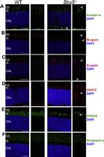 GNAT2 Antibody in Immunohistochemistry, Immunohistochemistry (Frozen) (IHC, IHC (F))