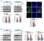 IBA1 Antibody in Western Blot (WB)