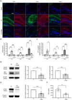 IBA1 Antibody in Western Blot (WB)