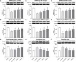 GABBR1 Antibody in Western Blot (WB)