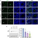 CDK6 Antibody in Immunohistochemistry (IHC)