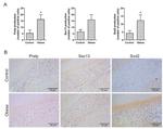 SOD2 Antibody in Immunohistochemistry (IHC)