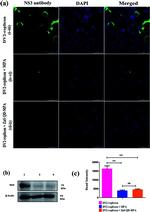 Dengue Virus Type 2 NS3 Antibody in Western Blot, Immunocytochemistry, In vitro Assay (WB, ICC/IF, IV)